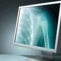 X-ray Badges: An Overview
